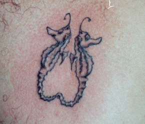 hippocampe